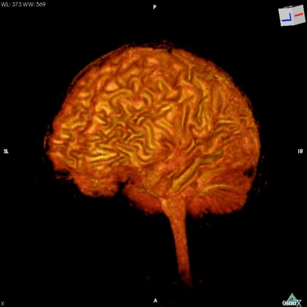 My Brain in 3D: Rendered Videos and Images of My fMRI Scan Data ...
