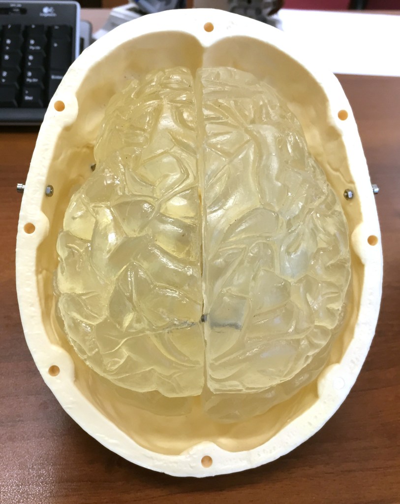 Human skull cap removed to show brain model